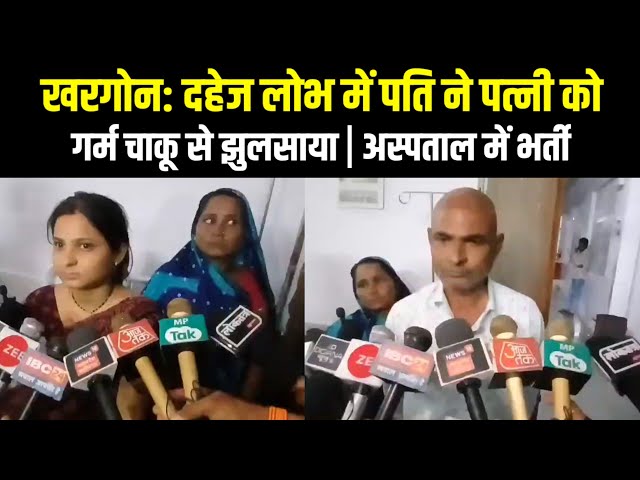 खरगोन: दहेज लोभ में पति ने पत्नी को गर्म चाकू से झुलसाया | अस्पताल में भर्ती | Khargon News Today