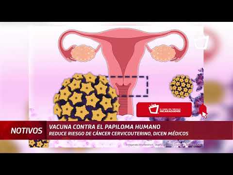 Vacuna del Papiloma Humano vendría a reducir cáncer cervicouterino en Nicaragua