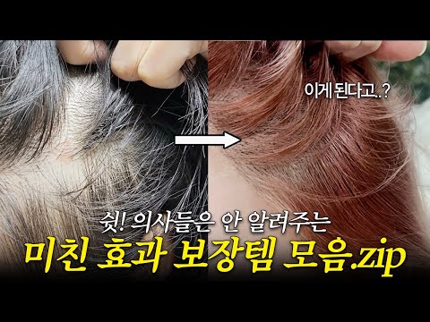 ⚠️인증사진 확실한 "비포애프터 완벽템 TOP 6"⚠️ (<strong>여성탈모</strong>, 블랙헤드, 트러블자국 etc.)