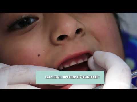#ConsejosMinsa | Caries dental