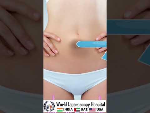 Laparoscopy is an effective treatment option for umbilical hernia.