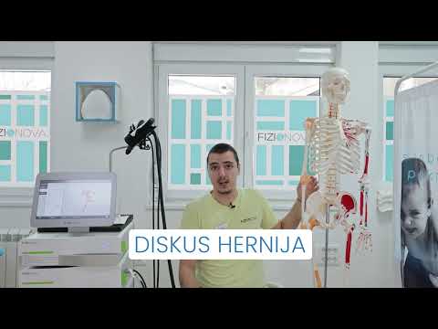 Bolovi u donjem delu leđa - Fizionova