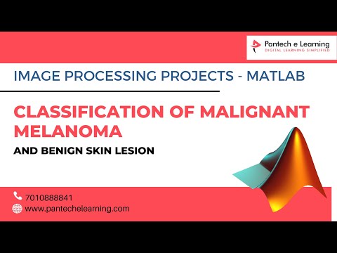 CLASSIFICATION OF MALIGNANT MELANOMA AND BENIGN SKIN LESION