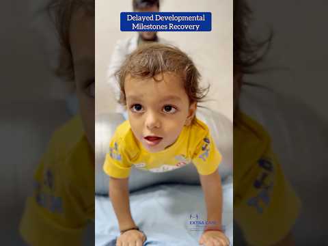 Kid Walking after Delayed Developmental Milestones | Extra Care Physiotherapy Lko 94555 55207