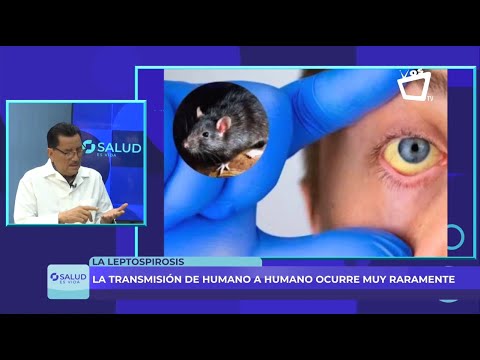 ¿Cómo se transmite la leptospirosis a humanos?