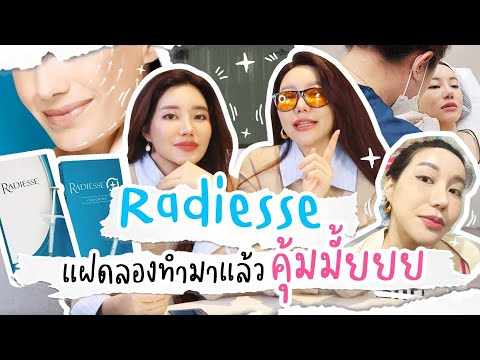 Radiesseตัวดังดีจริงมั้ยยลอ