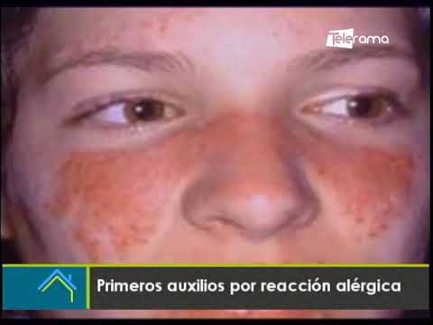 Primeros auxilios por reacción alérgica