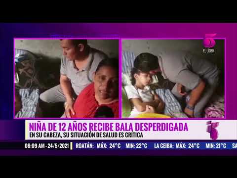 Padres piden ayuda para niña hondureña de 12 años, grave tras una bala perdida que impactó en su cab