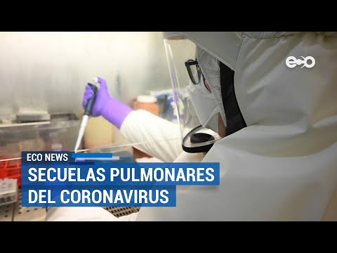 ¿Conoce las secuelas del nuevo coronavirus | ECO News