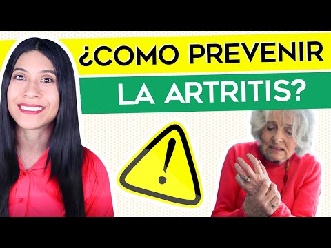 ¿Cómo prevenir la Artritis 5 Consejos para evitar la Artritis