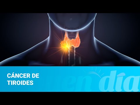 Cáncer de tiroides