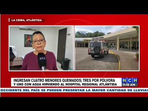 Ingresan cuatro menores quemados al Hospital Regional Atlántida