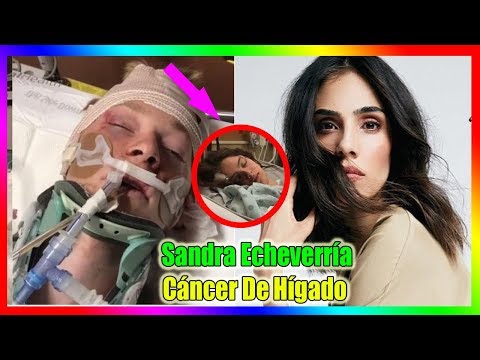 DIOS! Sandra Echeverría se desmayó después de recibir los resultados del examen: Cáncer De Hígado