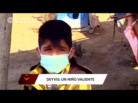 La Banda del Chino: Valiente niño no pierde la fe, pese a sufrir leucemia  (HOY)