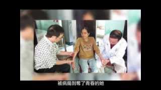 越南早衰重症患者重生