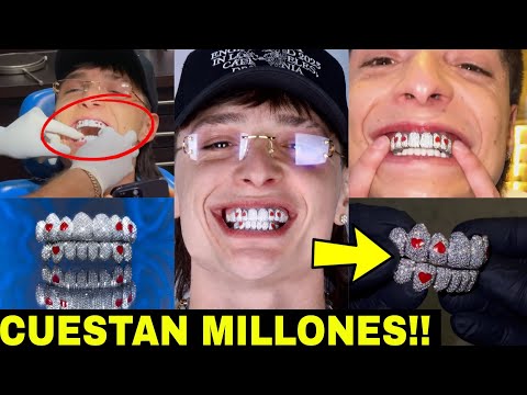 Peso Pluma PRESUME SU LUJOSA Y EXTRAVAGANTE prótesis de dientes con diamantes de más 50 Mil Dólares