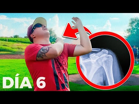 Creo Que Me Tendré Que OPERAR EL HOMBRO  | Gamer Fitness Día 6