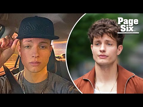 Matt Rife explains why his face changed, denies plastic surgery 'conspiracies'