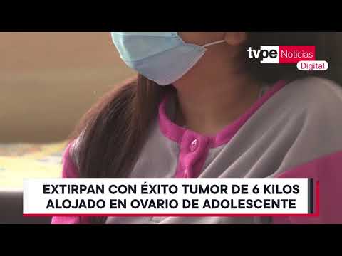 Compleja cirugía extirpa tumor de 6 kilos alojado en ovario de adolescente
