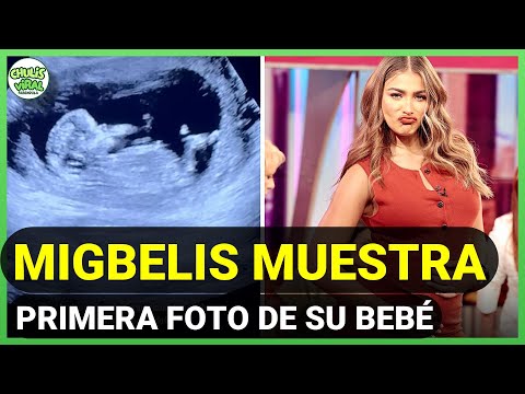 Migbelis Castellanos MUESTRA la PRIMERA FOTO de su bebé, ¿es niño o niña?