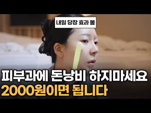 2천원이면 됩니다. 진짜 여드름 없어지는 피부 관리 루틴