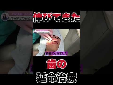 頼むから長生きして…！伸びてきた歯の延命治療