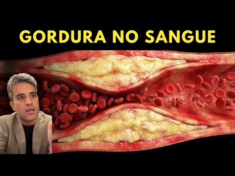 BEBA 1 XÍCARA POR DIA - Combate Gordura no Fígado e Emagrece Rápido