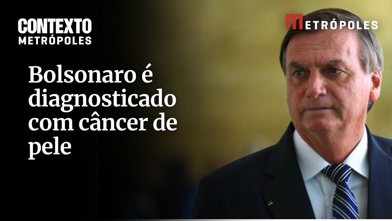 Bolsonaro é diagnosticado com câncer de pele e recebe alta de hospital em Brasília