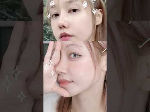 드디어ㅠㅠ 망한 <strong>코재수술</strong> 성공하뮤ㅠㅠㅠ✨