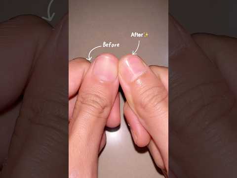 Kuku jadi glowing😍 @alvawardanii  @Lalitahutami