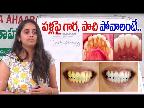 Tips To Keep Your Teeth Strong || Teeth Whitening at Home || Dr Sarala || SumanTV HealthCare