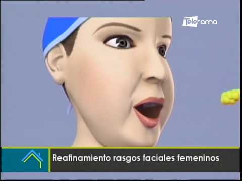 Estética al Día: Reafinamiento rasgos faciales femeninos