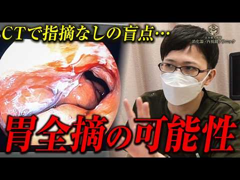 胃がんの初期症状は見つけにくい！？專門醫が明かす胃がんの恐ろしさと胃カメラの重要性とは？