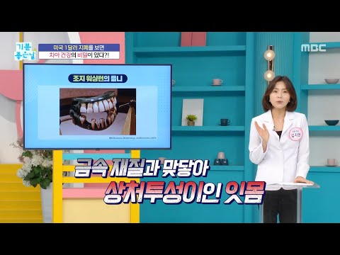 [기분 <strong>좋은</strong> <strong>날</strong>] 무시무시한 18세기 틀니의 형태, MBC 260820 방송