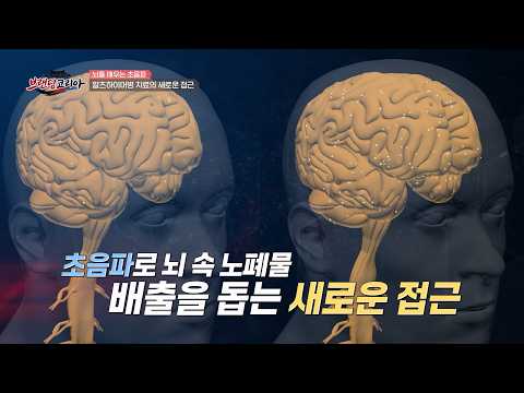 [#브랜딩코리아] 초음파로 알츠하이머병을 치료한다? 알츠하이머병 치료의 새로운 접근 | 브랜딩 코리아 16회