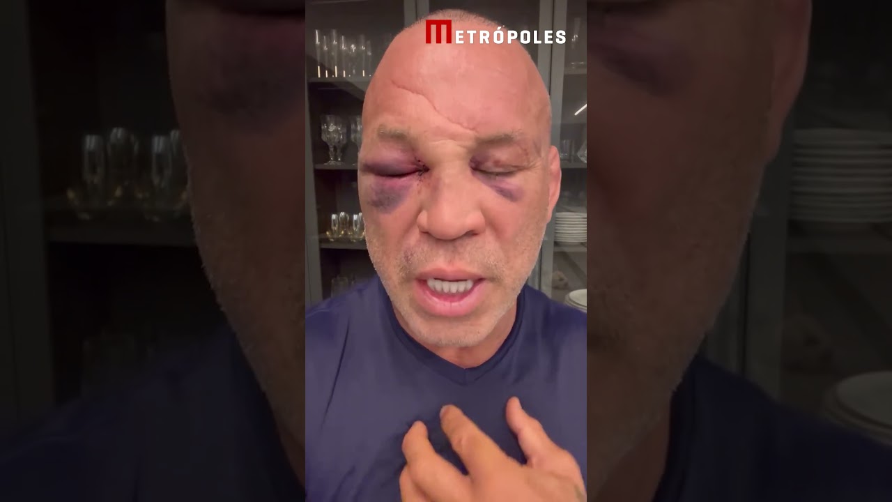 Wanderlei Silva lamenta situação e mostra detalhes de recuperação