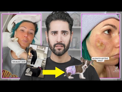 Kayla.Nicole.g's Chemical Peel Nightmare: Importance of Advocating for Health
