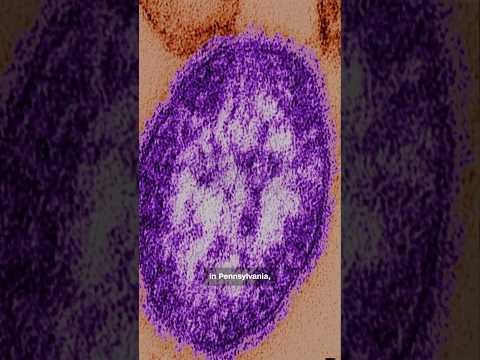 Click to play Video