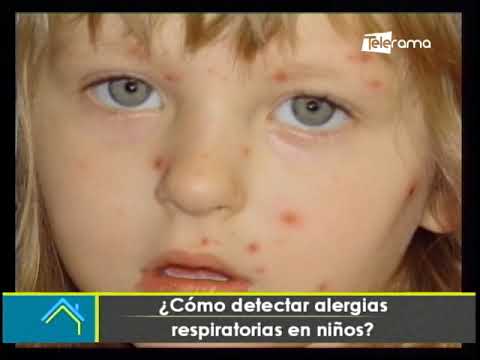 ¿Cómo detectar alergias respiratorias en niños?