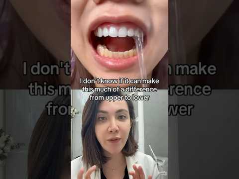Does Teeth Whitening Strips Work?!