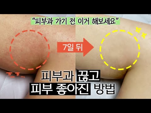 수천만원 쓰고 깨달은 ‘피부 좋아지는 법’🔥드디어 찾아낸 꿀팁..🥲 (NO광고)