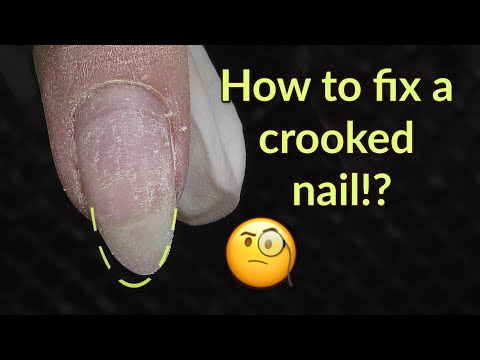 How to Fix Crooked Nail | Gel Overlay Fill