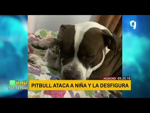 Salvaje ataque: pitbull desfigura rostro de niña de dos años en Huacho