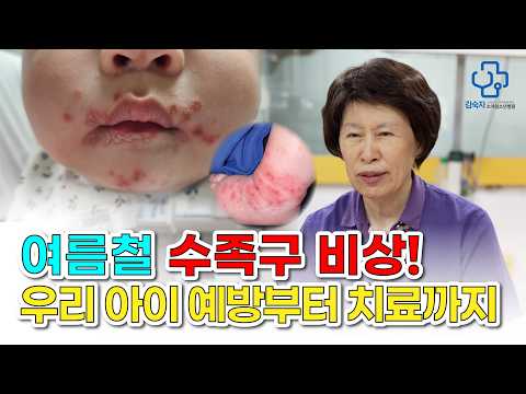 [육아닥터 김숙자] 여름철 <strong>수족구</strong> 비상! 우리 아이 예방부터 치료까지