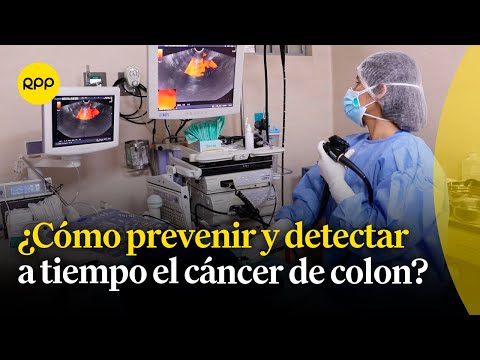 ¿Cómo prevenir y detectar a tiempo el cáncer de colon?