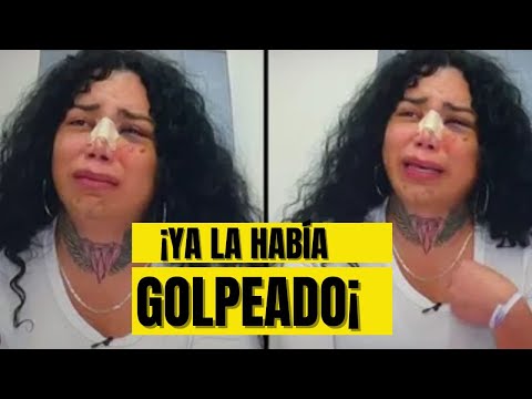 Paola Suárez revela que su ex novio ya la había golpeado