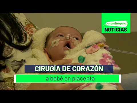 Cirugía de corazón a bebé en placenta - Teleantioquia Noticias