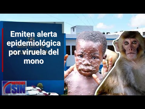 #SINFinDeSemana: Viruela del mono, velan y operativo