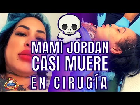 MAMI JORDAN CASI MUERE AHOGADA, EN CIRUGÍA PLÁSTICA, EN PLENO QUIRÓFANO