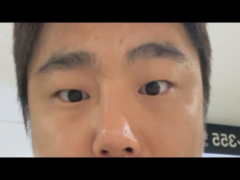 <strong>중고차</strong> 실제상황